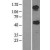 Western Blot: ABAT Lysate [NBL1-07169] - Western Blot experiments. 
Left-Control; Right -Over-expression Lysate for ABAT